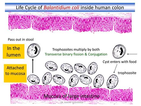 PPT - Balantidium coli PowerPoint Presentation, free download - ID:2120321