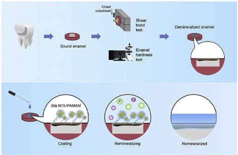 Schematic illustration of demineralization of enamel and... | Download ...