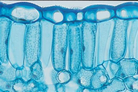 Palisade cells of a hellebore (Helleborus sp.) leaf | Palisade cell, Microscopic photography ...