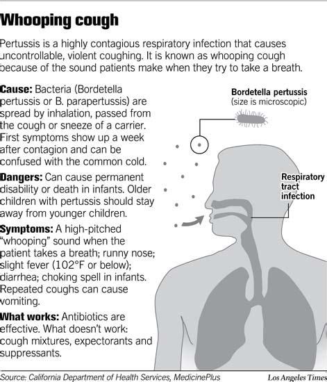 Whooping Cough/Pertussis: What you need to know | Whooping cough, Cough, Medical information