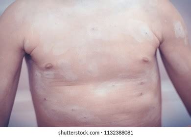 143 Morbillivirus Images, Stock Photos & Vectors | Shutterstock