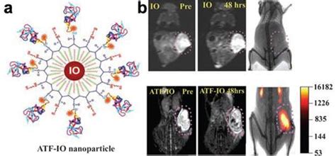 Improving the Magnetic Resonance Imaging Contrast and Detection Methods with Engineered Magnetic ...