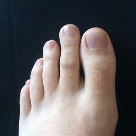 Is Your Second Toe Taller Than Other Toes? What It Says About Your ...