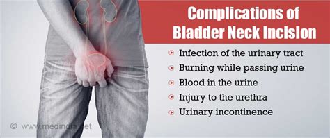 Bladder Neck Incision - Indications, Types and Complications