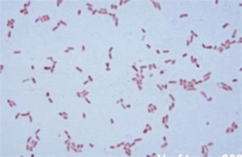 (Get Answer) - can this negative Gram stain be of Salmonella ...