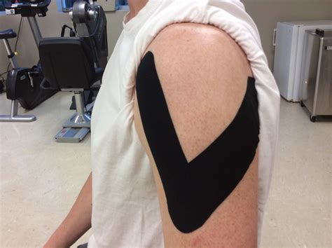 Support Your Shoulder With Kinesiology Tape