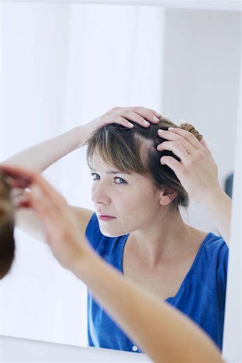 Scabs on scalp: how to get rid of scabs? | Head&Shoulders UK