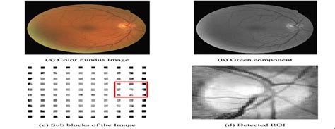 localization of optic disc | Download Scientific Diagram