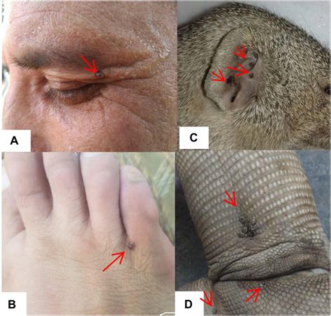 Frontiers | Seasonal Dynamics, Record of Ticks Infesting Humans, Wild and Domestic Animals and ...