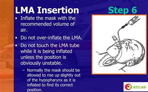 Laryngeal Mask Airway & Igel - An Introduction | PPT