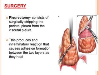 Pleural effusion & nursing care | PPT