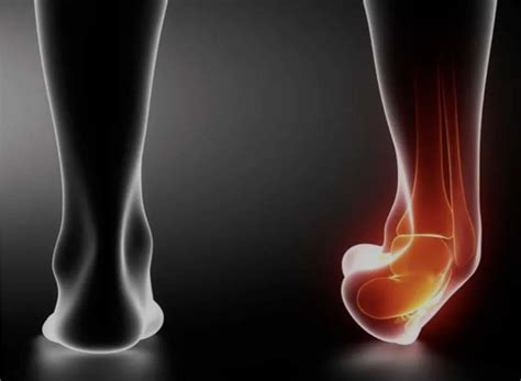 What Causes Chronic Ankle Instability? | Watsonia Podiatry