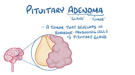 Pituitary adenoma: Video, Anatomy & Definition | Osmosis