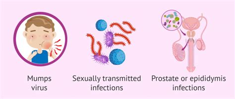 What is Testicular Orchitis? Symptoms, Causes and Treatment