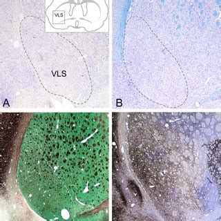 The ventrolateral striatum is a characteristic striatal subfield The... | Download Scientific ...