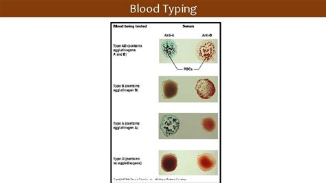 Blood transfusion Physiology By Dr Sunita Mittal Learning