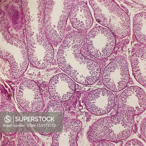 Histological slide of human testis seen under a microscope, at x100 ...