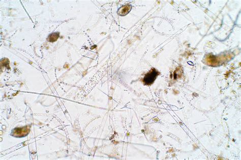 1,900+ Plankton Microscope Stock Photos, Pictures & Royalty-Free Images ...