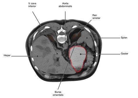 18+ Anatomy Gaster PNG