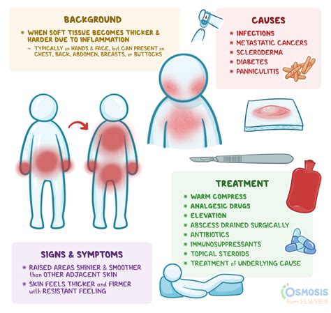 Induration: What Is It, Causes, and More | Osmosis