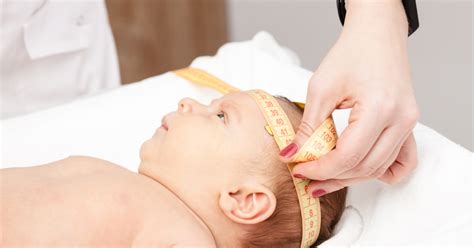 Treating Plagiocephaly (Surgery, Helmets and Repositioning)