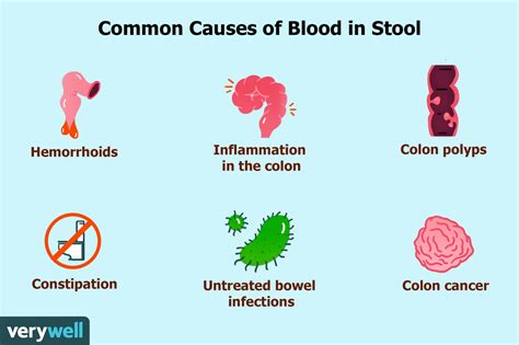 Dark blood in stool - vgfer