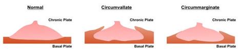 What is the Placenta?