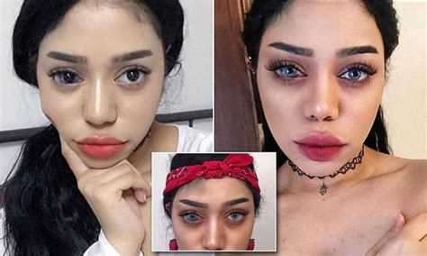 Instagram star with eyeball birthmark slams critics | Daily Mail Online