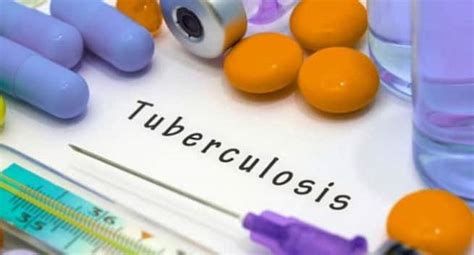 Artificial Intelligence may help in diagnosing Tuberoculosis - Read ...