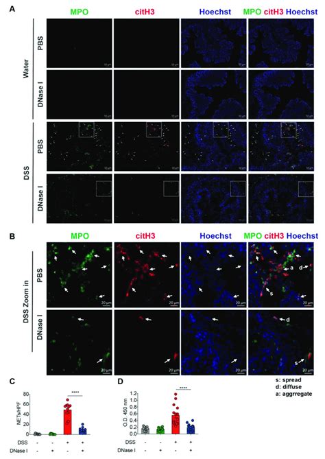 DNase I treatment significantly degrades NET structure in the colon of... | Download Scientific ...