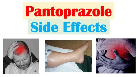 Pantoprazole (& Omeprazole) Side Effects (Including Nutrient ...