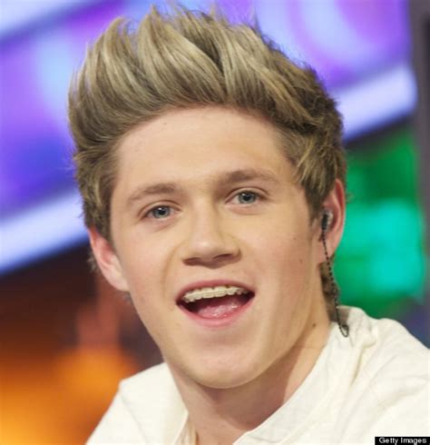 One Direction's Niall Horan Shows Off His New Smile After Getting ...