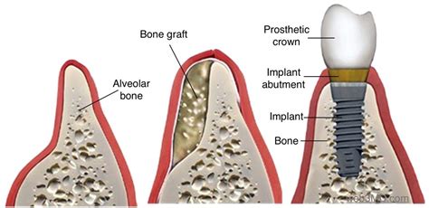 Oral and Maxillofacial Surgery