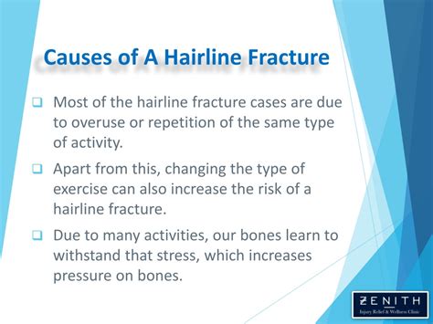 PPT - Hairline Fracture - Causes, Symptoms and Treatment PowerPoint Presentation - ID:11752160