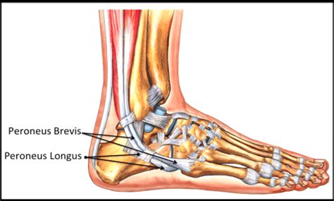 Peroneal tendon tears of the ankle: Orthopedic Center for Sports ...