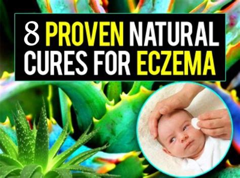 8 Natural Ways to Treat Eczema | Natural cure for eczema, Home remedies for eczema, Eczema cure