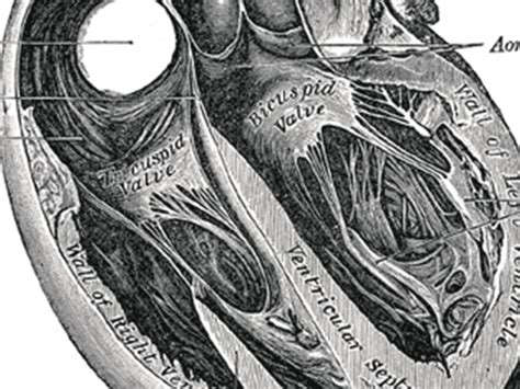 Pericardial Drain Management Protocol - Best Drain Photos Primagem.Org