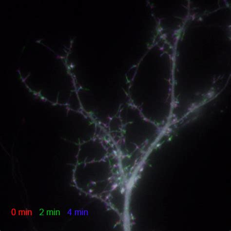 (PDF) Dendritic spine morphology and dynamics in health and disease