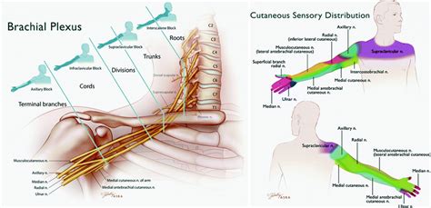 Brachial Plexus Block | Anesthesia Key