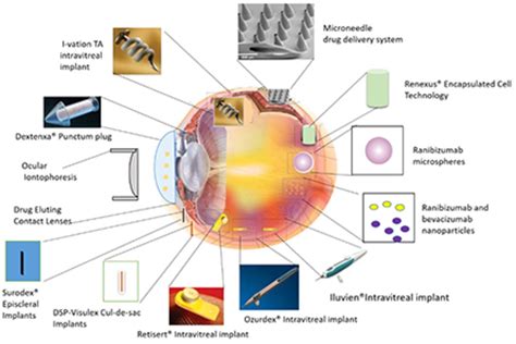 Ocular Drug Delivery: Present Innovations and Future Challenges | Journal of Pharmacology and ...