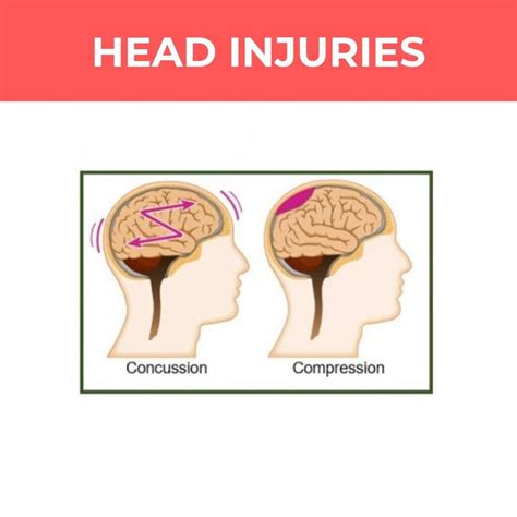 At a basic first aid level, head injuries can be broadly split into two ...