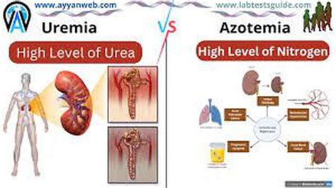 Azotemia and Uremia: A Comprehensive Overview - MedLinkage