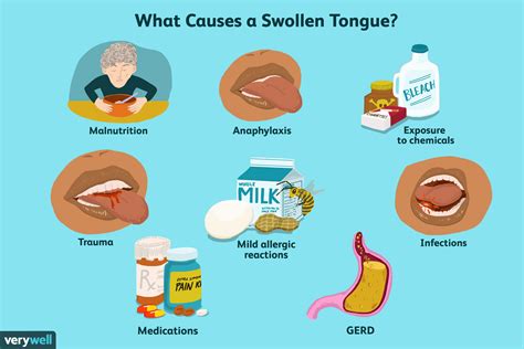 Sore Throat Swollen Tongue And Lips | Lipstutorial.org