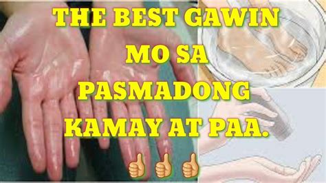 PASMADONG KAMAY..ETO ANG SOLUSYON PARA MAWALEY ANG PAGTUTUBIG NG KAMAY AT PAA. #21Vlog - YouTube