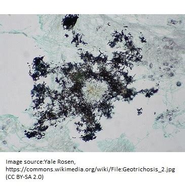 Geotrichum - Everything You Need to Know