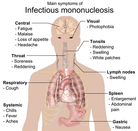 The Kissing Disease – The Talon