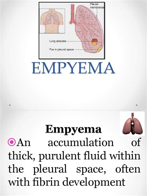 Empyema 171013100219 | PDF | Medical Specialties | Health Sciences