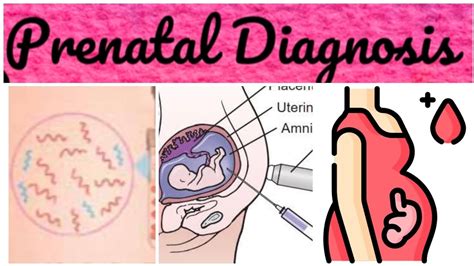 Prenatal Diagnosis - YouTube