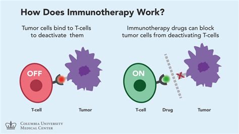 Targeted Therapy vs Immunotherapy: Which Is Right for You, Key Differences & Similarities ...