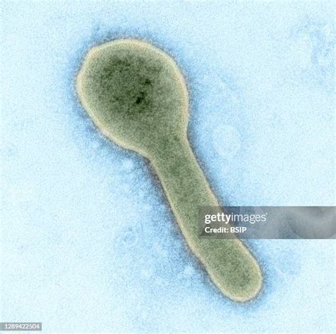 367 Marburg Virus Stock Photos, High-Res Pictures, and Images - Getty ...